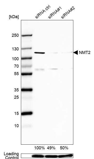 NMT2 Antibody - BSA Free Western Blot: NMT2 Antibody - BSA Free [NBP1-85817]