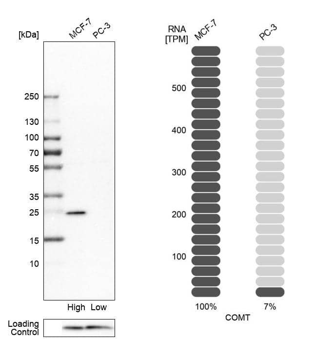 COMT Antibody - BSA Free Western Blot: COMT Antibody - BSA Free [NBP1-85818]