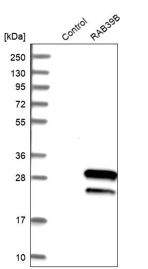 RAB39B Antibody - BSA Free Western Blot: RAB39B Antibody - BSA Free [NBP1-85819]