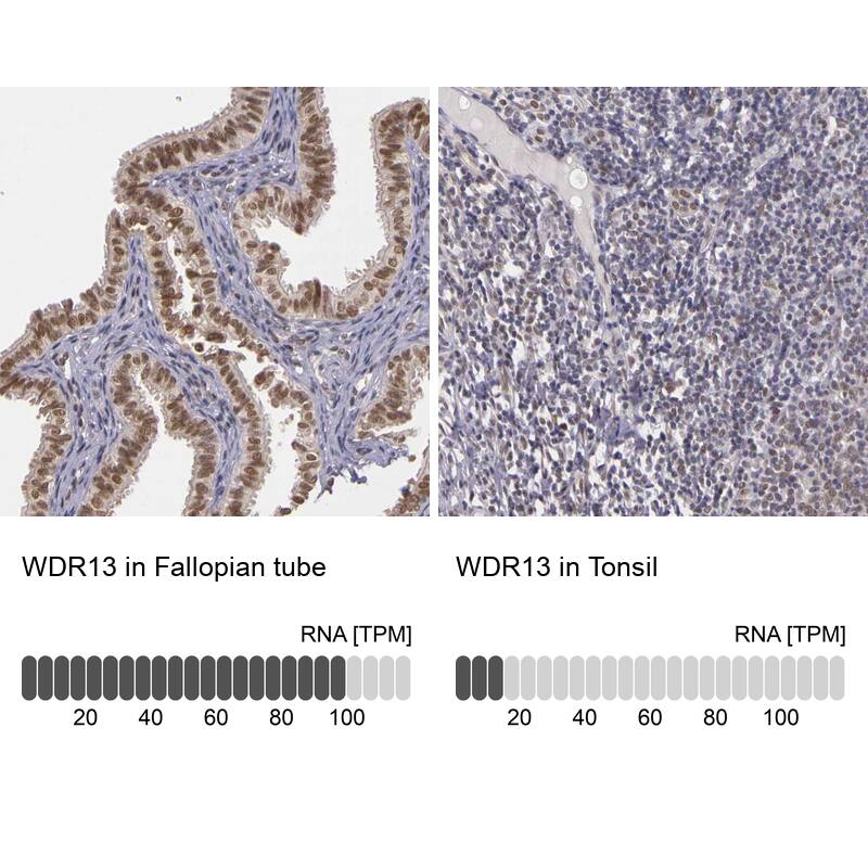 WDR13 Antibody - BSA Free Immunohistochemistry-Paraffin: WDR13 Antibody - BSA Free [NBP1-85820]