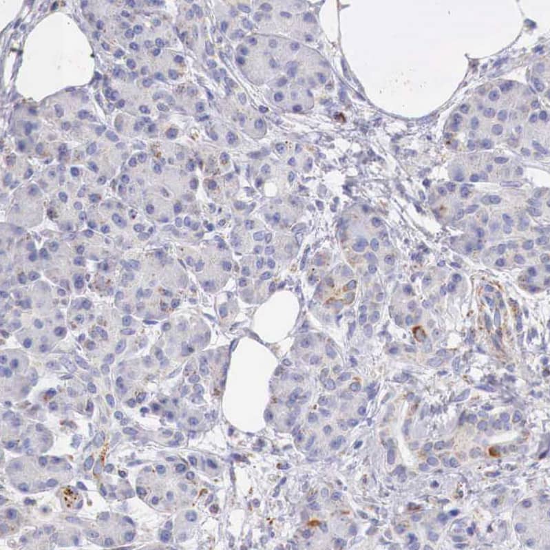 IDH3G Antibody - BSA Free Immunohistochemistry-Paraffin: IDH3G Antibody [NBP1-85824]