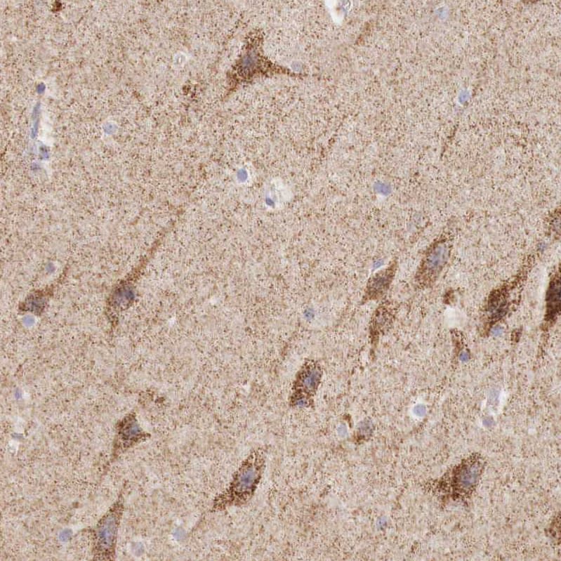 IDH3G Antibody - BSA Free Immunohistochemistry-Paraffin: IDH3G Antibody [NBP1-85824]