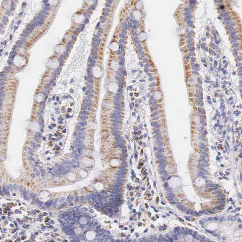 IDH3G Antibody - BSA Free Immunohistochemistry-Paraffin: IDH3G Antibody [NBP1-85824]