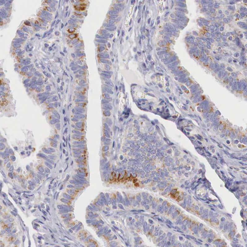 IDH3G Antibody - BSA Free Immunohistochemistry-Paraffin: IDH3G Antibody [NBP1-85824]