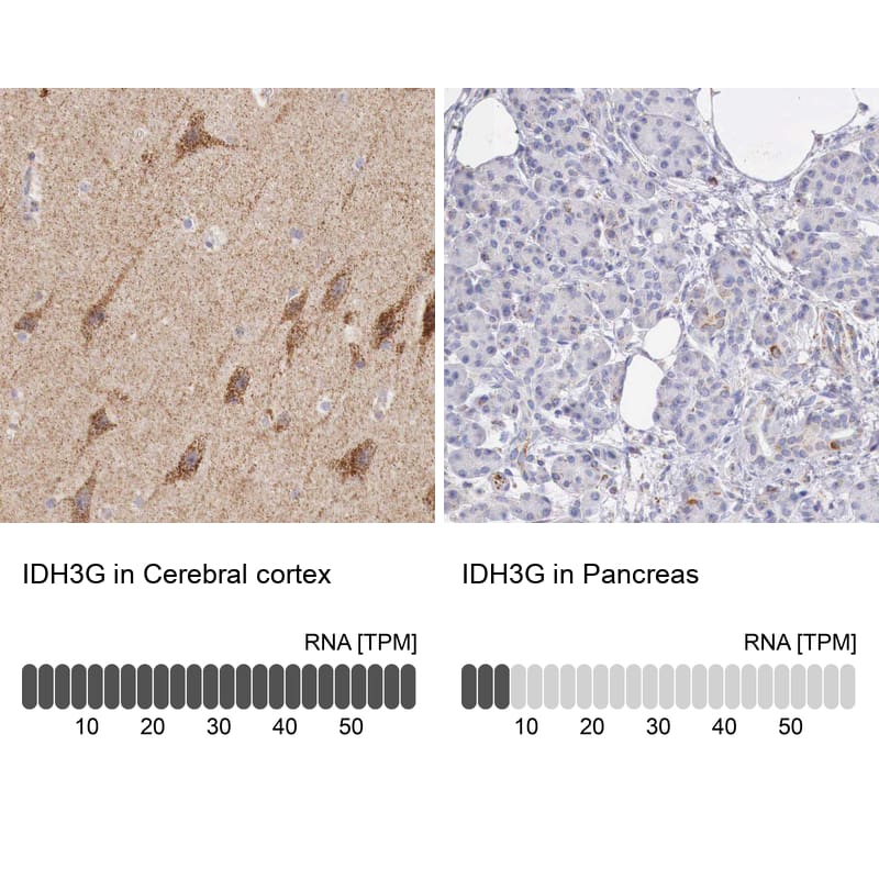IDH3G Antibody - BSA Free Immunohistochemistry-Paraffin: IDH3G Antibody - BSA Free [NBP1-85824]