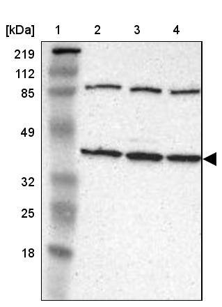 IDH3G Antibody - BSA Free Western Blot: IDH3G Antibody - BSA Free [NBP1-85824]