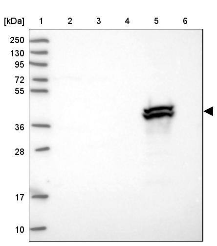 BHMT2 Antibody - BSA Free Western Blot: BHMT2 Antibody - BSA Free [NBP1-85826]