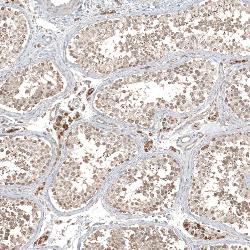 CPNE7 Antibody - BSA Free Immunohistochemistry-Paraffin: CPNE7 Antibody - BSA Free [NBP1-85827]