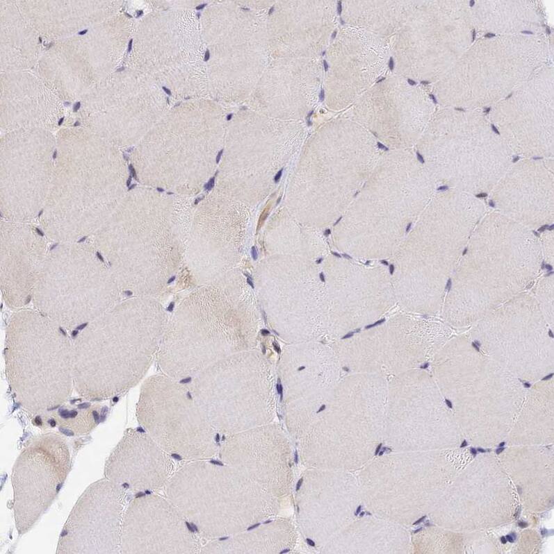 PEX16 Antibody - BSA Free Immunohistochemistry-Paraffin: PEX16 Antibody - BSA Free [NBP1-85828]