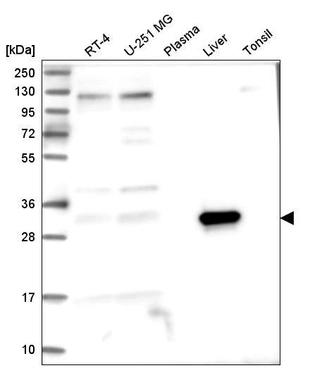 ASPDH Antibody - BSA Free Western Blot: ASPDH Antibody - BSA Free [NBP1-85832]