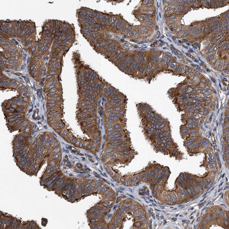 MDM1 Antibody - BSA Free Immunohistochemistry-Paraffin: MDM1 Antibody - BSA Free [NBP1-85839]