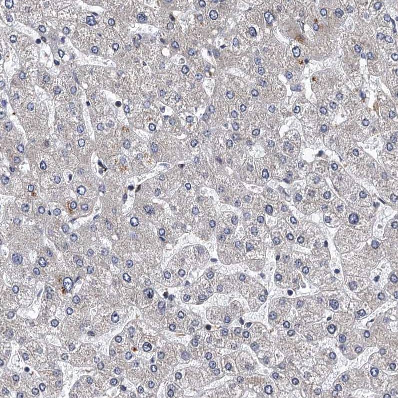 MDM1 Antibody - BSA Free Immunohistochemistry-Paraffin: MDM1 Antibody - BSA Free [NBP1-85839]