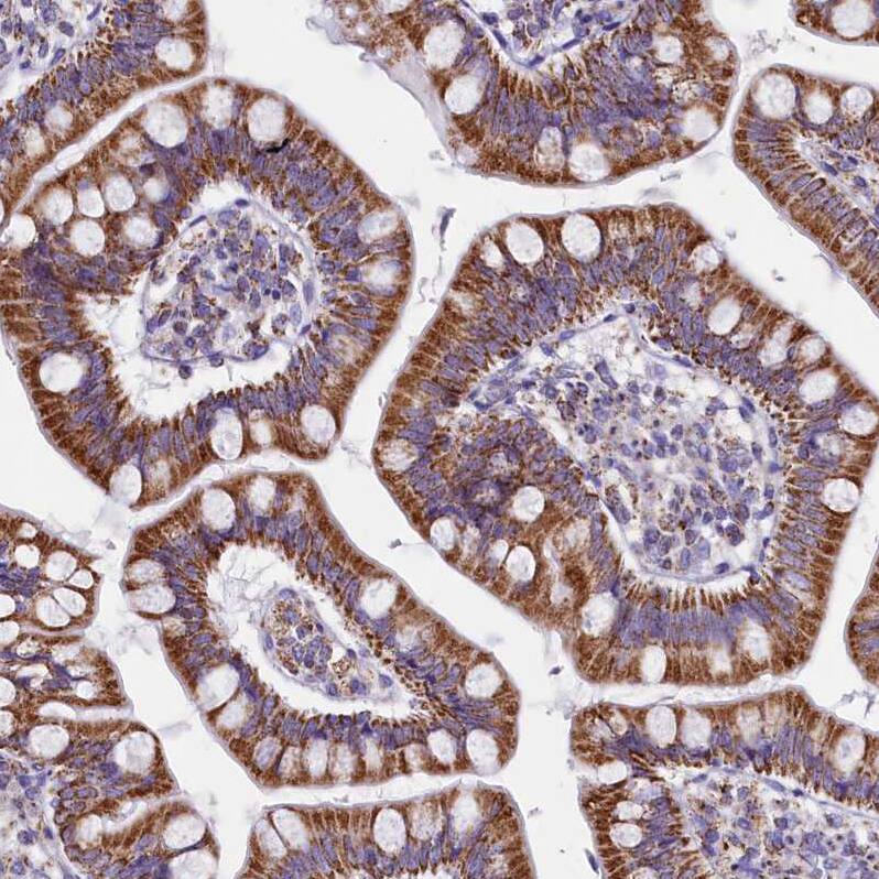 IDH3A Antibody - BSA Free Immunohistochemistry-Paraffin: IDH3A Antibody [NBP1-85840]