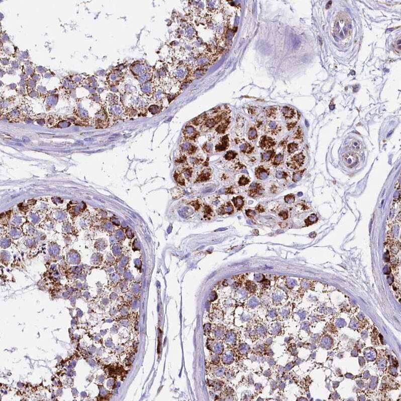 IDH3A Antibody - BSA Free Immunohistochemistry-Paraffin: IDH3A Antibody [NBP1-85840]