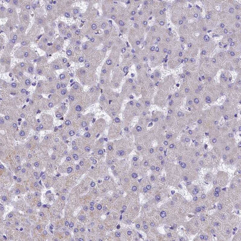 IDH3A Antibody - BSA Free Immunohistochemistry-Paraffin: IDH3A Antibody [NBP1-85840]