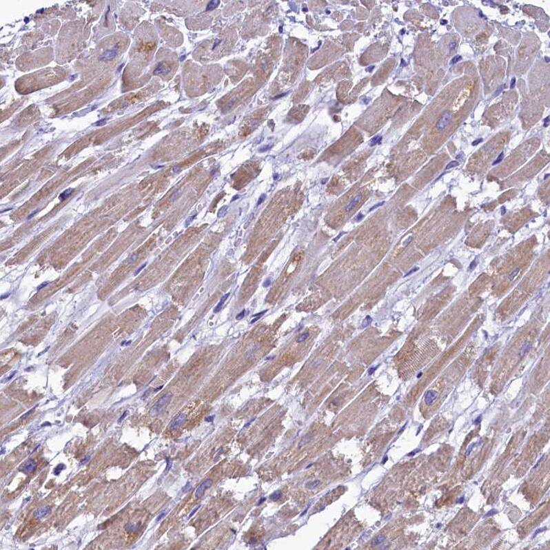 IDH3A Antibody - BSA Free Immunohistochemistry-Paraffin: IDH3A Antibody [NBP1-85840]