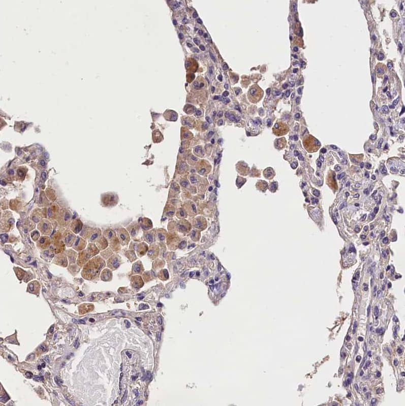 OAS3 Antibody - BSA Free Immunohistochemistry-Paraffin: OAS3 Antibody - BSA Free [NBP1-85845]