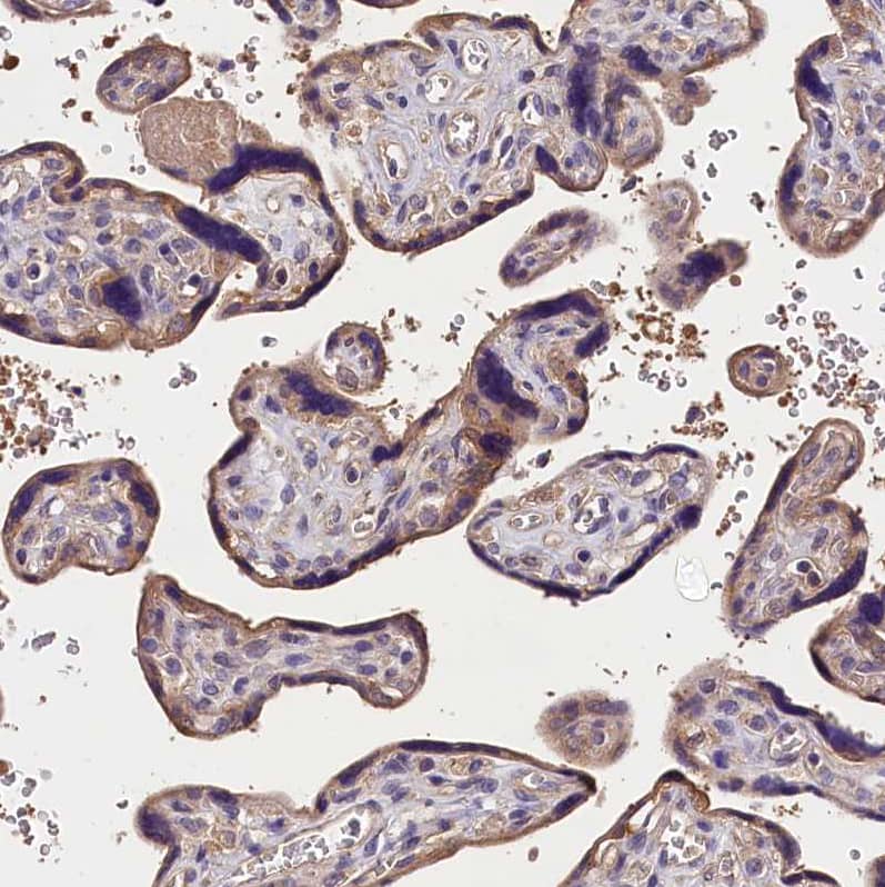 OAS3 Antibody - BSA Free Immunohistochemistry-Paraffin: OAS3 Antibody - BSA Free [NBP1-85845]