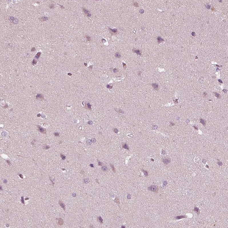 PSTPIP2 Antibody - BSA Free Immunohistochemistry-Paraffin: PSTPIP2 Antibody - BSA Free [NBP1-85846]