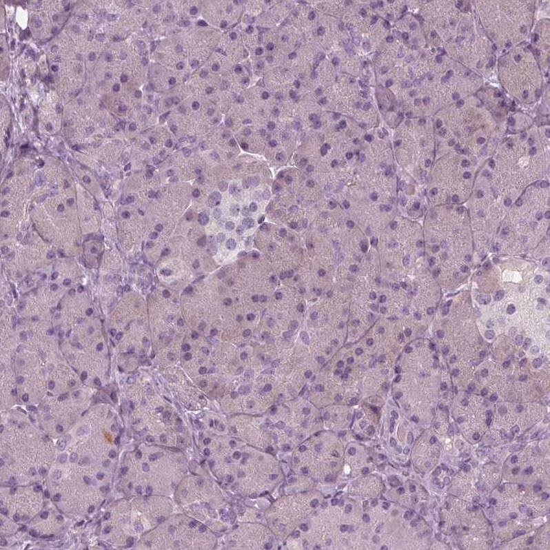 PSTPIP2 Antibody - BSA Free Immunohistochemistry-Paraffin: PSTPIP2 Antibody - BSA Free [NBP1-85846]