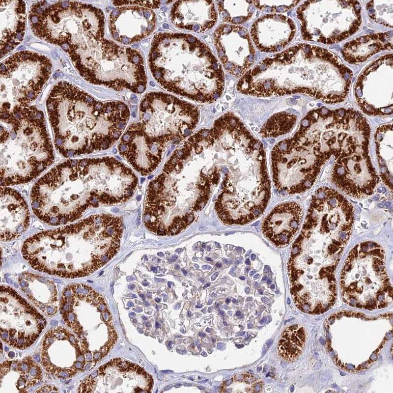 ADAT1 Antibody - BSA Free Immunohistochemistry-Paraffin: ADAT1 Antibody [NBP1-85850]