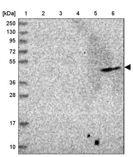 ADAT1 Antibody - BSA Free Western Blot: ADAT1 Antibody - BSA Free [NBP1-85850]