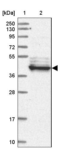 LRRC2 Antibody - BSA Free Western Blot: LRRC2 Antibody - BSA Free [NBP1-85853]