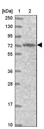PIGB Antibody - BSA Free Western Blot: PIGB Antibody - BSA Free [NBP1-85856]