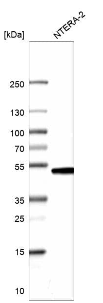 CMAS Antibody - BSA Free Western Blot: CMAS Antibody - BSA Free [NBP1-85858]