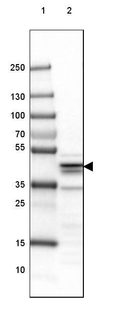 SUCLA2 Antibody - BSA Free Western Blot: SUCLA2 Antibody - BSA Free [NBP1-85860]