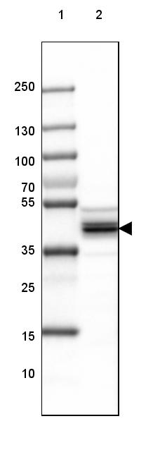 SUCLA2 Antibody - BSA Free Western Blot: SUCLA2 Antibody - BSA Free [NBP1-85860]