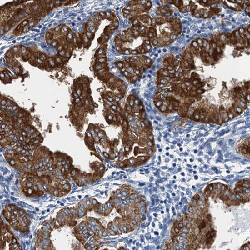 GADL1 Antibody - BSA Free Immunohistochemistry-Paraffin: GADL1 Antibody [NBP1-85863]