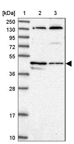 TEDC1 Antibody - BSA Free Western Blot: TEDC1 Antibody - BSA Free [NBP1-85864]