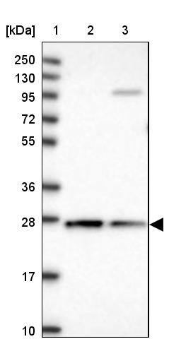 CYB5R2 Antibody - BSA Free Western Blot: CYB5R2 Antibody - BSA Free [NBP1-85865]