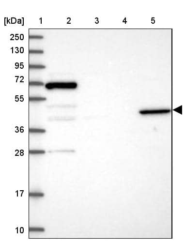 Angiopoietin-like Protein 5/ANGPTL5 Antibody - BSA Free Western Blot: Angiopoietin-like Protein 5/ANGPTL5 Antibody - BSA Free [NBP1-85870]
