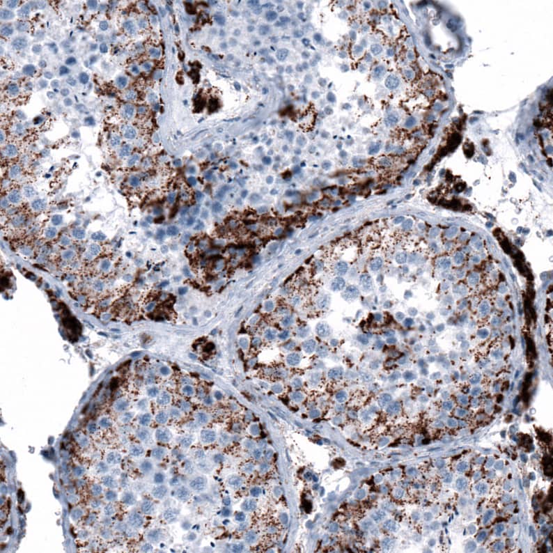 ME3 Antibody - BSA Free Immunohistochemistry-Paraffin: ME3 Antibody [NBP1-85871]