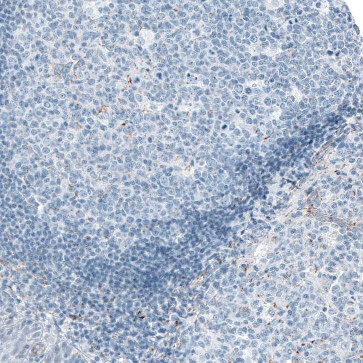 ME3 Antibody - BSA Free Immunohistochemistry-Paraffin: ME3 Antibody [NBP1-85871]