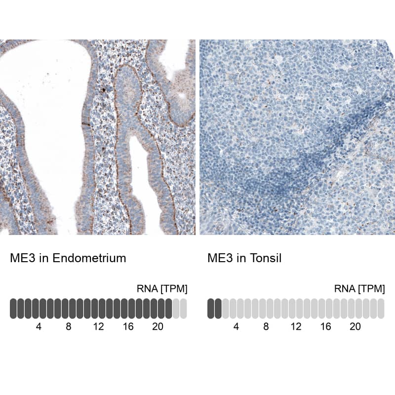 ME3 Antibody - BSA Free Immunohistochemistry-Paraffin: ME3 Antibody [NBP1-85871]