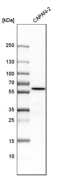 ME3 Antibody - BSA Free Western Blot: ME3 Antibody - BSA Free [NBP1-85871]