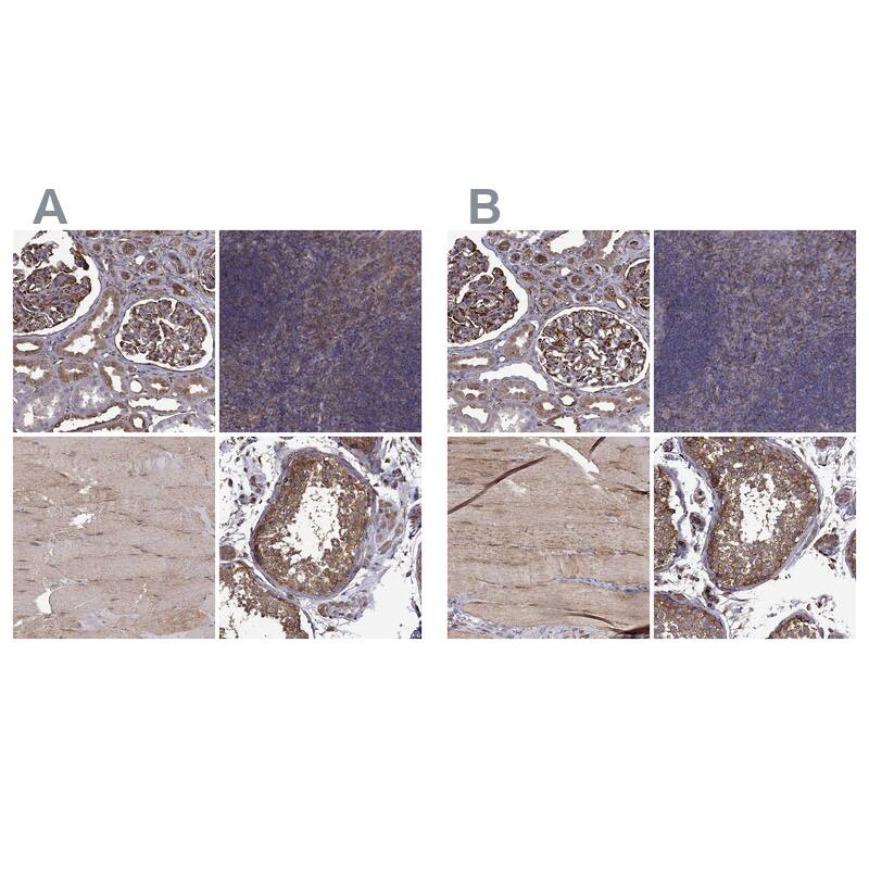 MAP4 Antibody - BSA Free Immunohistochemistry-Paraffin: MAP4 Antibody - BSA Free [NBP1-85874]