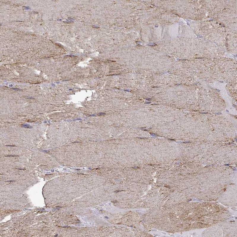 MAP4 Antibody - BSA Free Immunohistochemistry-Paraffin: MAP4 Antibody - BSA Free [NBP1-85874]