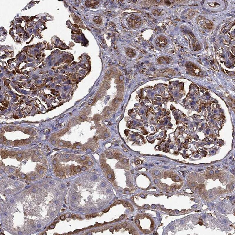 MAP4 Antibody - BSA Free Immunohistochemistry-Paraffin: MAP4 Antibody - BSA Free [NBP1-85874]