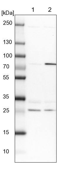 GBE1 Antibody - BSA Free Western Blot: GBE1 Antibody - BSA Free [NBP1-85875]