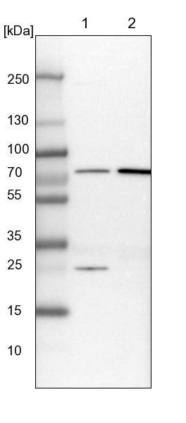 GBE1 Antibody - BSA Free Western Blot: GBE1 Antibody - BSA Free [NBP1-85876]