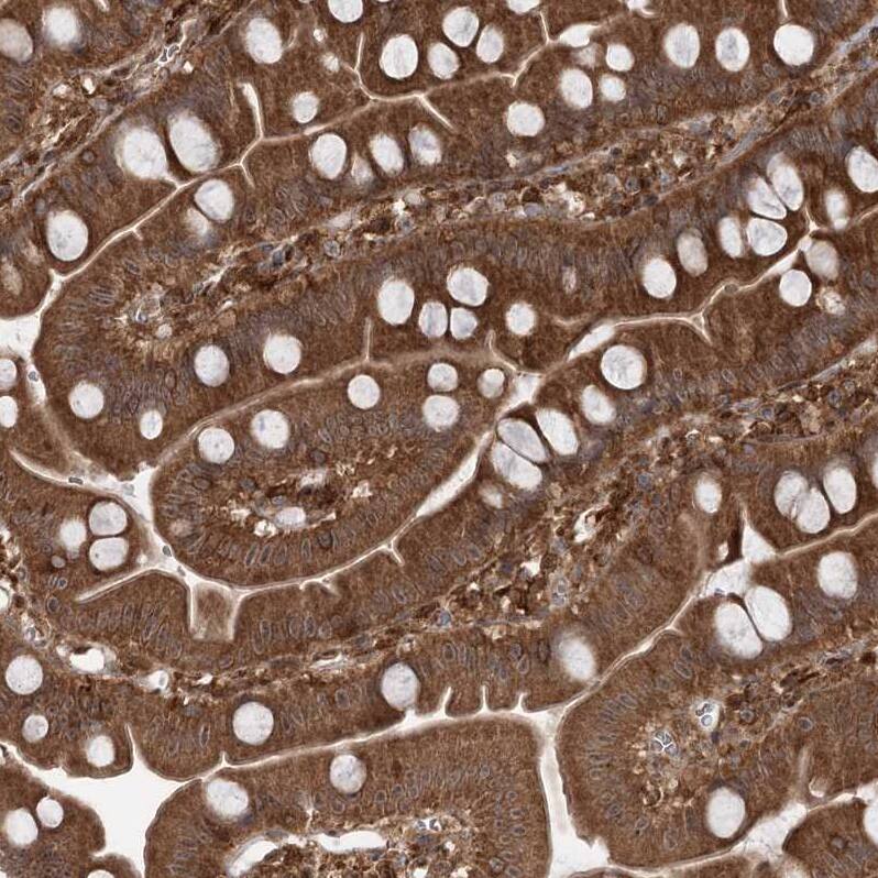 C12orf4 Antibody - BSA Free Immunohistochemistry-Paraffin: C12orf4 Antibody - BSA Free [NBP1-85878]