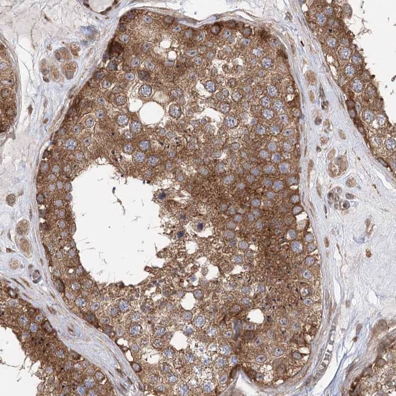 C12orf4 Antibody - BSA Free Immunohistochemistry-Paraffin: C12orf4 Antibody - BSA Free [NBP1-85878]
