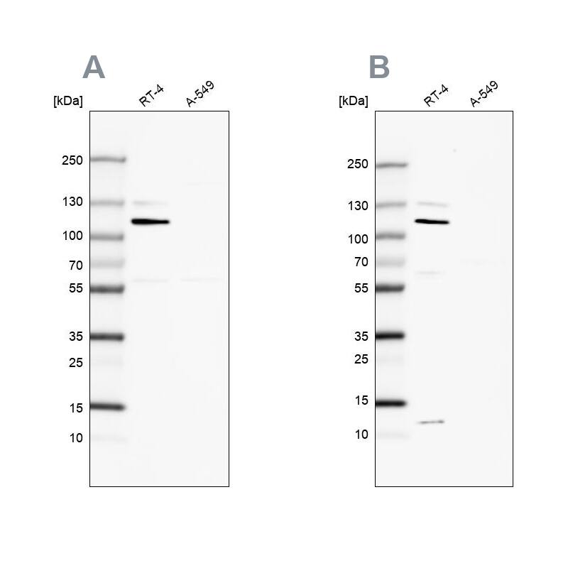 MCC Antibody - BSA Free Western Blot: MCC Antibody - BSA Free [NBP1-85885]