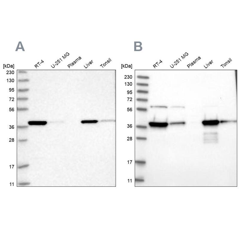 HIBCH Antibody - BSA Free Western Blot: HIBCH Antibody - BSA Free [NBP1-85891]