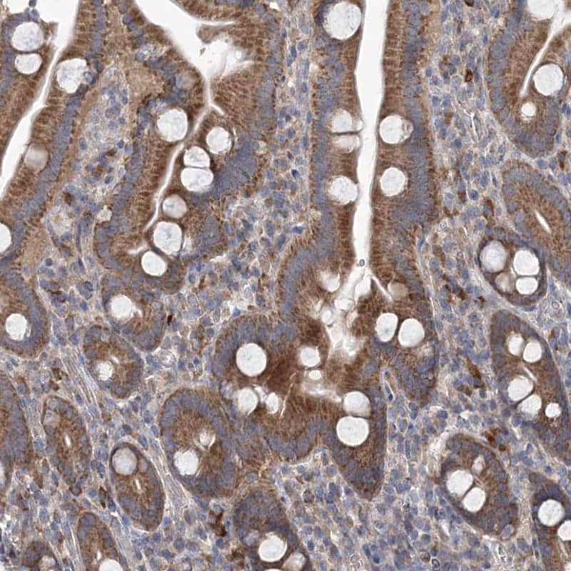 MTRF1L Antibody - BSA Free Immunohistochemistry-Paraffin: MTRF1L Antibody [NBP1-85893]