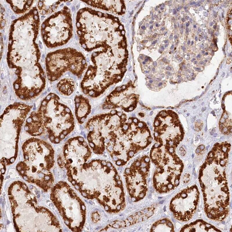 UMPS Antibody - BSA Free Immunohistochemistry-Paraffin: UMPS Antibody [NBP1-85895]